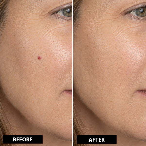 BEFORE AFTER 2