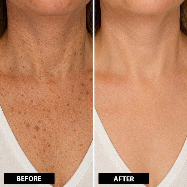 BEFORE AFTER 3