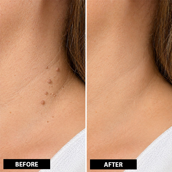 BEFORE AFTER 4