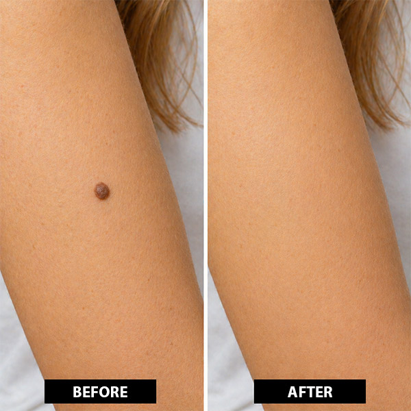 BEFORE AFTER 6