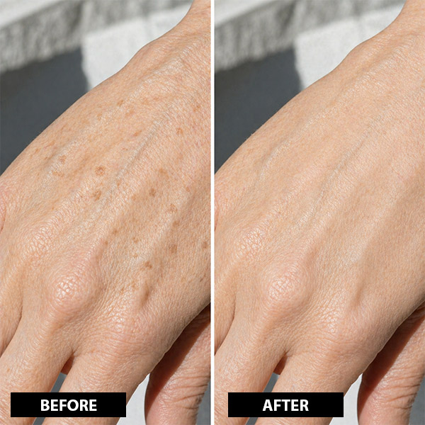BEFORE AFTER 7